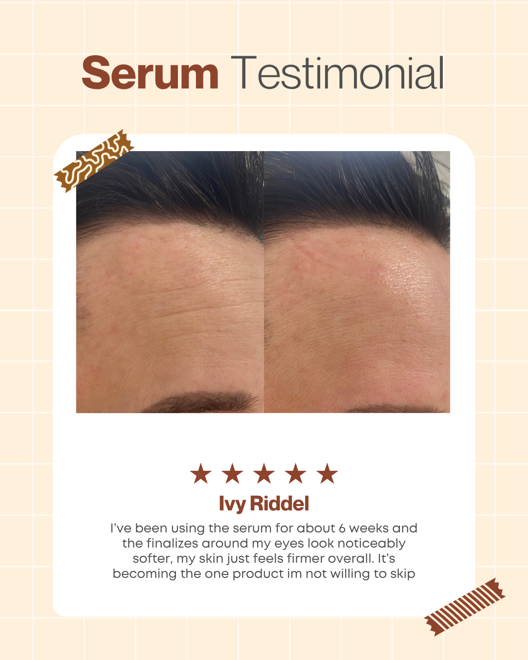 Deep Renewal Serum